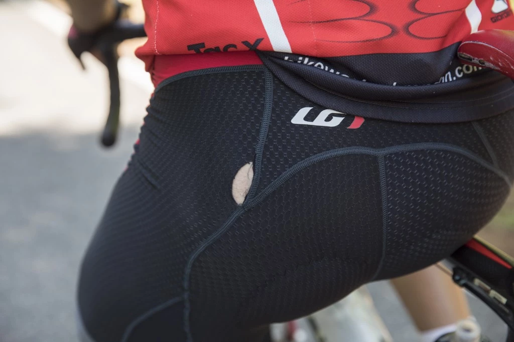 bike shorts - the louis garneau cb carbon 2 developed a large hole in the left...